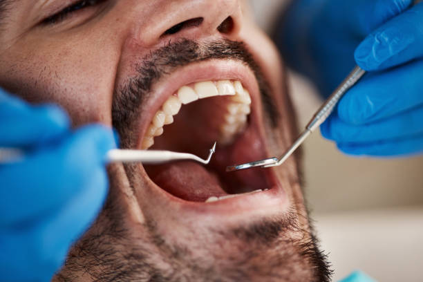 Best Dental Abscess Treatment in Yale, OK